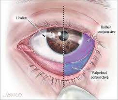 Bulbar Conjunctiva Humpath Com Human Pathology In 2021 Pathology Eye Anatomy Gross Anatomy