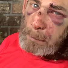 Fundraiser by Patricia Nagy : Help Jose Heal and Keep His Family Afloat