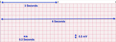 ekg paper lesson quiz