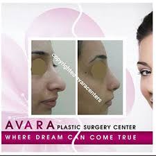 تجميل الانف تكلفة و أسعار عمليات التجميل للأنف أفارا plastic surgery surgery center surgery