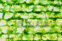 Over 271 plant cell microscope pictures to choose from, with no signup needed. Microscopic Plant Cells Images Kuhn Photo