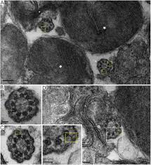 The cut produced by plasma jet is very clean and its quality can be improved by using a water injection arc plasma torch. Superresolution Microscopy Reveals Photoreceptor Specific Subciliary Location And Function Of Cep290 Biorxiv