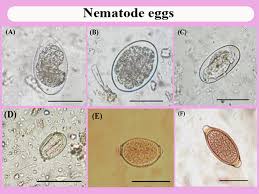 Protozoan And Helminthes Parasites Endorsed By Imported