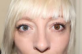 Heteros Chroma One Blue Eye One Brown Eye Casie Stewart