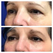 Our skilled team of physicians and medical aestheticians . Aesthetic Center Greenville Home Facebook