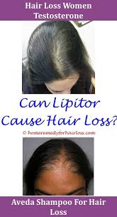 Loss Of Hair Might Be Abnormal If You Are Shedding More Than 100 Hairs A Day This May Cause A Basic Thinnin Help Hair Loss Hair Loss Reasons Hair Loss Therapy