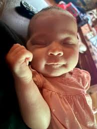 What causes brown dry edges