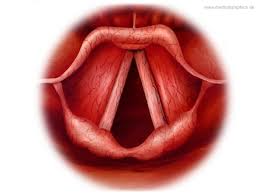 Image result for Acute Laryngitis