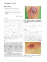 Usa300 probably emerged during the early 1990s. Pdf Recurrent Cutaneous Abscesses Due To Panton Valentine Leukocidin Pvl Positive Staphylococcus Aureus In Immunocompetent Patients With Travel History An Increasing Problem