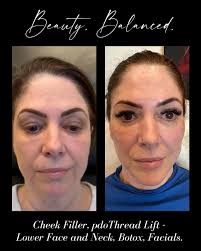 While balancing beauty may necessitate a brief investment of time, an  injector with a discerning vision, extensive experience, and impeccable  style can yield truly stunning, natural outcomes. This is Beauty. Balanced.  Book