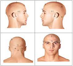 أماكن الحجامة في الرأس بالصور وفوائدها وأضرارها زيادة