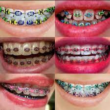 We did not find results for: Braces Trend Atau Keperluan 5 Perkara Ini Anda Perlu Tahu Sebelum Pakai Braces Semua Semua Semuanya