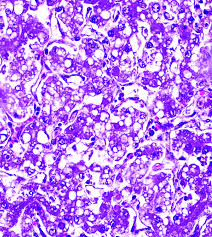 Image result for Crotalaria lanceolata