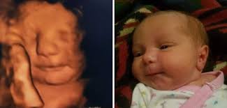 Meet Your New Neighbors