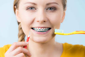 Keep your teeth clean all day long by continually brushing and flossing so your teeth can stay as white as possible. Brushing Your Teeth With Braces Arm Hammer