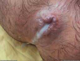 Gay hardcore porn - massive creampie and cum on ass