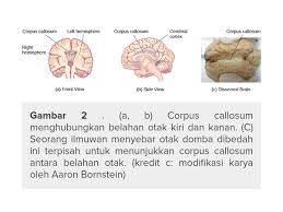 Bagi mereka yang dominan otak. Apa Fungsi Dari Otak Kanan Dan Otak Kiri Quora