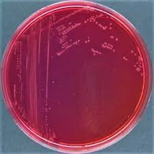 When xl agar is supplemented with sodium thiosulfate, ferric ammonium citrate, and sodium deoxycholate, it is then termed xld agar, and is. Morphology Culture Characteristics Of Shigella Dysenteriae