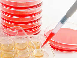 We did not find results for: Optimizing T Cell Media With Animal Component Free Recombinant Human Serum Albumin