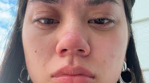 Fundraiser by Mary Pepper : Support My Journey Back