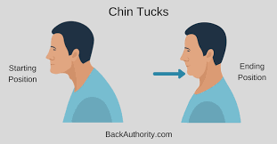 Chin Tucks Forward Head Posture Forward Head Posture Postures Chin Tuck