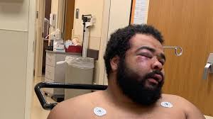 Fundraiser by Kimberly Jammeh : Help Isaiah with medical and justice