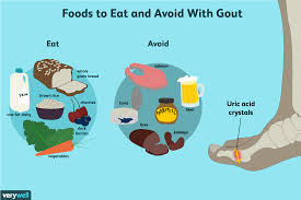 Gout What To Eat For Better Management