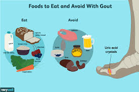 gout what to eat for better management