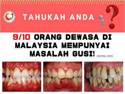 Pengawasan secara kontinyu oleh lembaga kesehatan sangat diperlukan terutama dalam kegiatan yang diutamakan pada upaya peningkatan kesehatan. Dr Faiz Dental Surgery Beaufort Dentist Dental Office Facebook