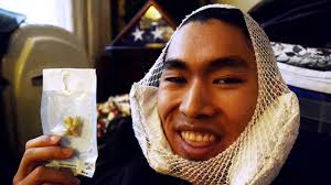 During the third molar of every person, the wisdom teeth will grow out. Wisdom Teeth Removal Walkthrough Tips Prep Reaction Aftermath And Recovery Youtube