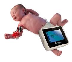 Image result for Sweat Chloride