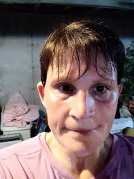 Morning workout and injury experiences