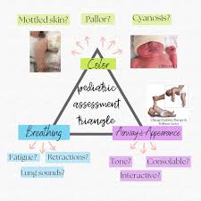 Image result for Pediatric Assessment Triangle