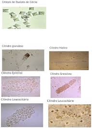 Grátis: Resumo Análise de sedimento, Sedimentoscopia - Material Claro e  Objetivo em PDF para Estudo Rápido
