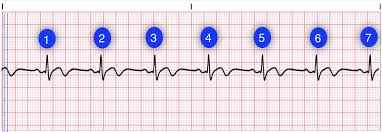 Heart Rate Lesson Quiz