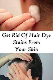 Get Rid Of Hair Dye Stains From Your Skin Girls Beauty Exposed Hair Dye Removal Hair Dye Tips Dyed Hair