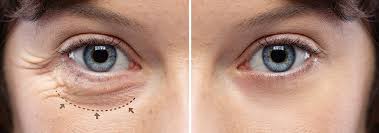 Image result for Blepharis transvaalensis