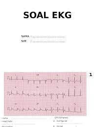 Contoh soal kuis kihajar sd 2019. Soal Ekg