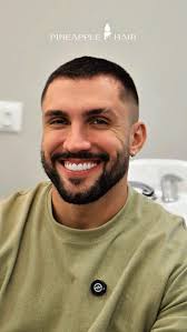 @arthurpicoli no 3º Mês de Tratamento Capilar: , Três meses após seu  transplante capilar, Arthur Picoli — retorna à clínica para um protocolo  que vai além do convencional. Desta vez, a estrela do ...