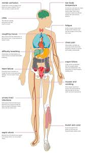 Chest radiographs are the most common film taken in medicine. The Effects Of Pneumonia On The Body