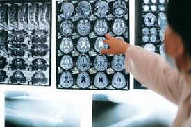 Spect = single photon emission computed tomography. Certificates