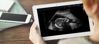 Your tummy, including confirmation of the sonographer. Mumsnet Dating Scan