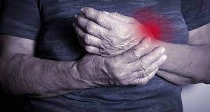 Please be sure of what your insurance covers. Advice From A Cht Hand Edema The Hand Society