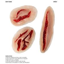 Image result for Skin Tear