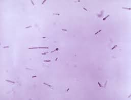 Listeria monocytogenes or just l. Bacteria Overview Amboss
