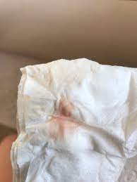 When you are in week 7 of pregnancy, important changes occur to your cervix. 7 Weeks Bleeding Spotting Help