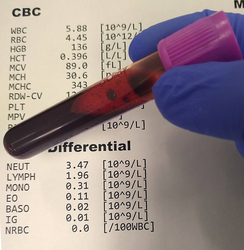 ESR product image