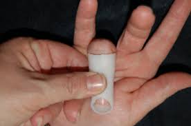 Ring splints stabilize the finger and control the movement of the joint in its normal range. Mallet Finger Splinting Handlab Resources