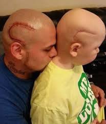 John Farnham's Recovery from Cancer Surgery