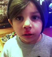 The Air Around Aliso Canyon Is Declared Safe. So Why Are Families Still  Suffering?